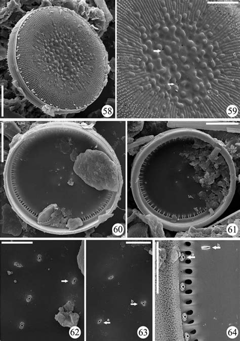 SEM. Cyclotella prespanensis spec. nov. Figs 58-63. Lake Prespa fossil... | Download Scientific ...