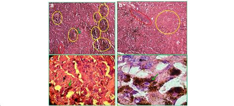 Histopathologic sections obtained from melanoma tumor autopsy in mouse ...