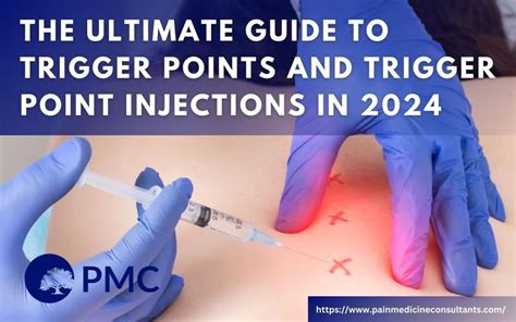 The Ultimate Guide to Trigger Points and Trigger Point Injections in ...
