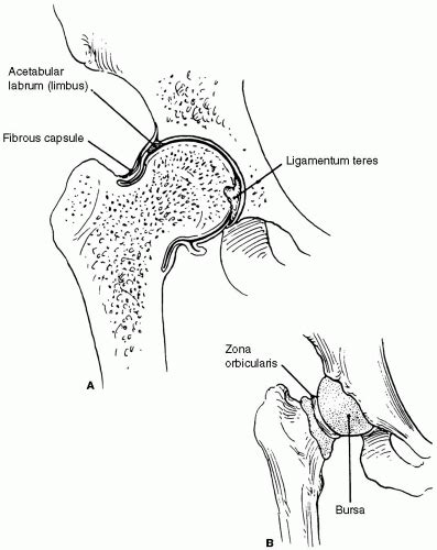 Arthrogram, Hip | Radiology Key