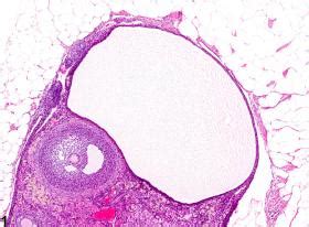 Ovary, Follicle - Cyst - Nonneoplastic Lesion Atlas