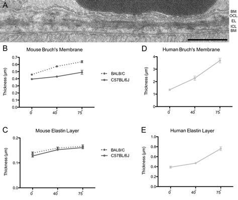 Bruch’s membrane and elastin layer thickness. (A) EM micrograph of ...