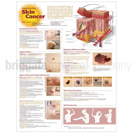 Laminated Chart - Understanding Skin Cancer - Briggate Medical Company