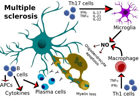 Overview of immunopathology in multiple sclerosis - SciMeditor