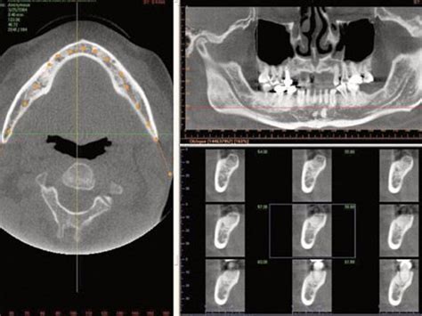 CT Scans in Dentistry - Cascades Center for Dental Health