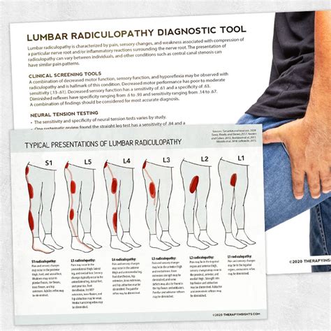 Lumbar Radiculopathy Patterns