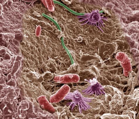 The Microorganism Survival Toolkit: Dormancy – ScIU