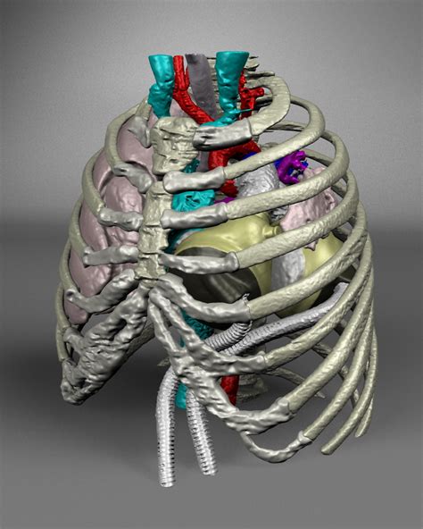 Virtual artificial heart implantation project earns tech competition award