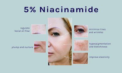 Niacinamide