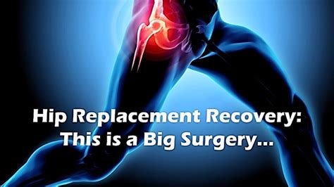 Hip Replacement Recovery: What To Know & What To Expect