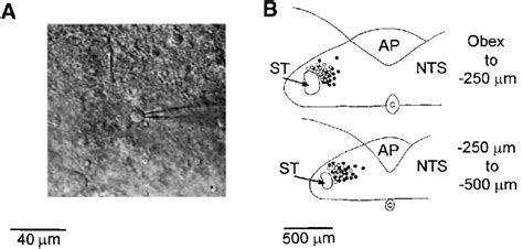 Location of neurons in nucleus tractus solitarii (NTS) that displayed... | Download Scientific ...