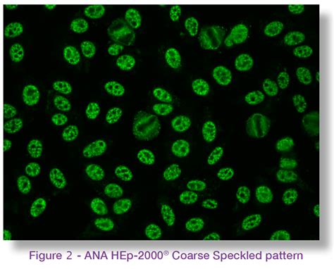 Immuno Concepts Technical Bulletin: Reporting Homogeneous and Speckled ANA patterns - Abacus dx