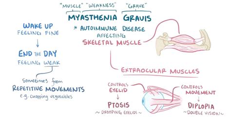 Myasthenia gravis: Video, Anatomy & Definition | Osmosis