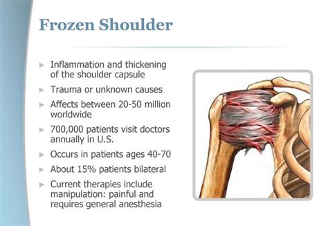 15 best Common Pain Syndromes We Treat images on Pinterest | Health, Physical therapy and Bones