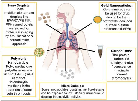 Application of nanotechnology in Pulmonary embolism. Nanotechnologies ...