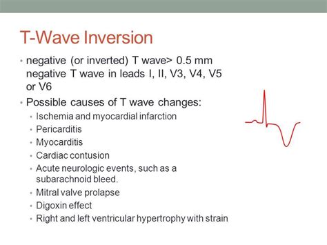 causes of T wave inversion in ECG - Cardiology and CCU