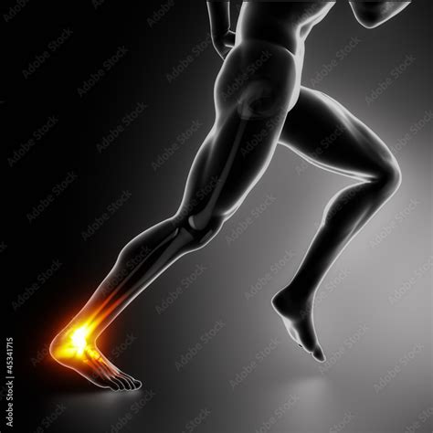 Sports ankle and achilles heel injury concept Stock Illustration ...