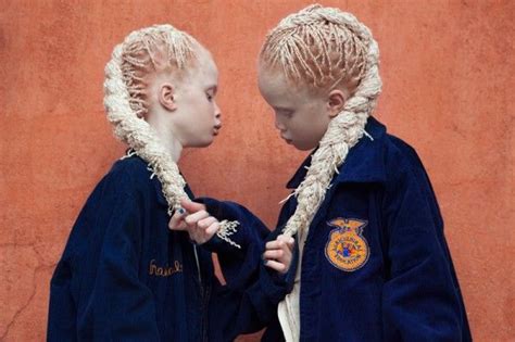 Flores Raras, albino twins from Brazil, photography by Vinicius ...