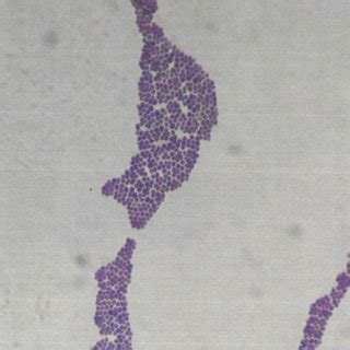 Positive Gram-stain (Micrococcus luteus) (Image: Tim Sandle) | Download ...