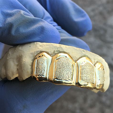 Custom Grillz Gold Diamond Dust Gold Plated Over 925 Sterling Silver Grills | Grillz, Custom ...