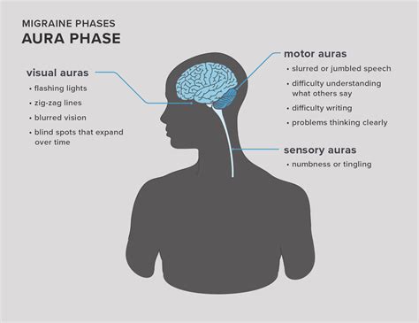 Ocular Migraine Blind Spot