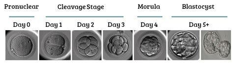 Complete Guide to Embryo Grading and Success Rates - Remembryo