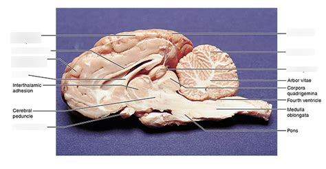 Sheep Brain Diagram Labeled