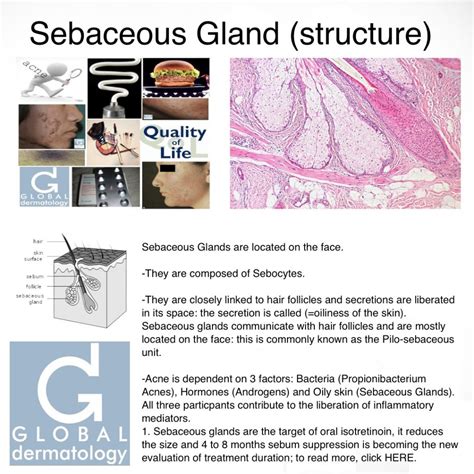 Global Dermatology » Sebaceous Gland (structure) (Instagram)