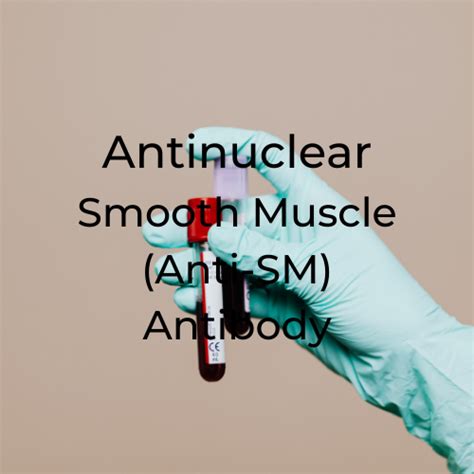 Antinuclear Smooth Muscle (Anti-SM) Antibody – Patholab Laboratory