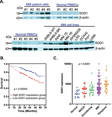 SOD1 expression and prognostic relevance in MM a Purified tumor cells... | Download Scientific ...