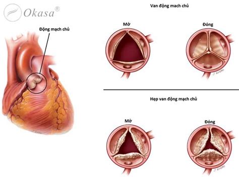 Những bệnh lý thường gặp liên quan đến tim