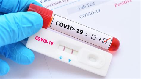 LAMP PCR Test Kit from the Institute of Nanotechnology | STATNANO