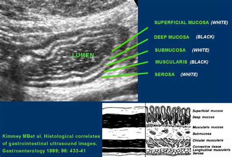 Ultrasound Anatomy