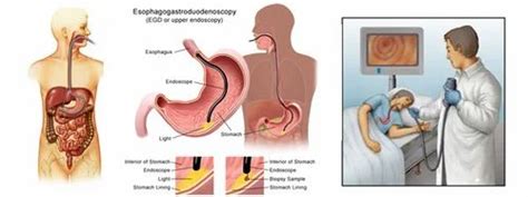 MEDICAL GASTROENTEROLOGY - Upper Gi Endoscopy Service Provider from ...