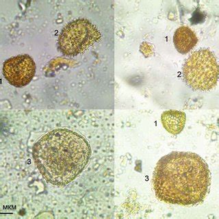 Micrographs of the spores indicating the plowing. 1 -Lycopodium... | Download Scientific Diagram