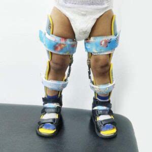 Medax Medical|best prosthetic & orthotic products in Saudi Arabia