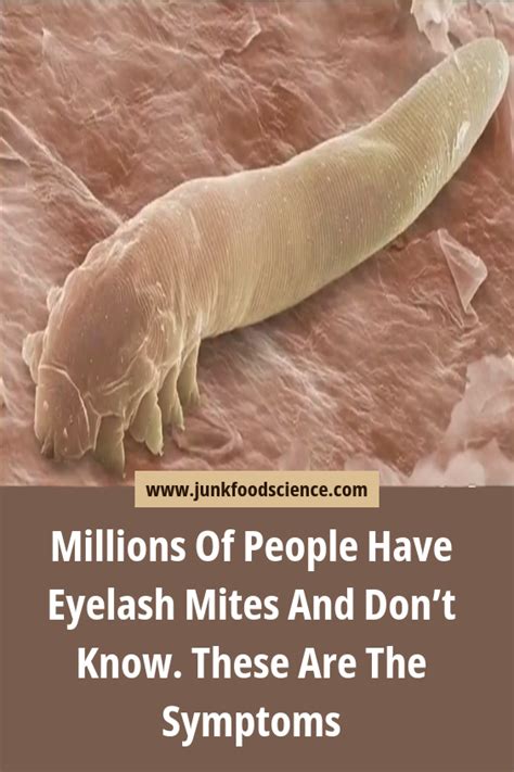 Millions Of People Have Eyelash Mites And Don’t Know. These Are The Symptoms | Health and ...