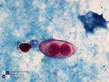 isospora belli | Protists, Microbiology, Parasite