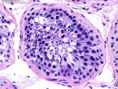 Webpathology.com: A Collection of Surgical Pathology Images