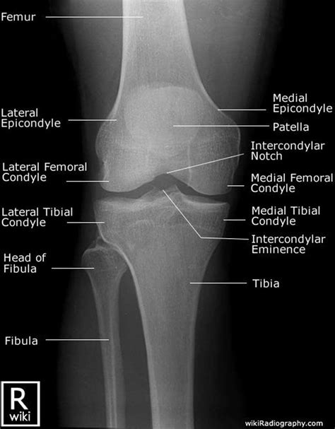 Registered at Namecheap.com | Radiology student, Medical knowledge, Medical anatomy