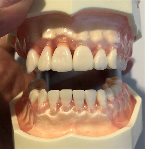 Anterior Secondary (permanent teeth) numbering Diagram | Quizlet