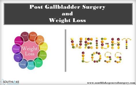 Weight Loss Post Gallbladder Surgery - Southlake General Surgery