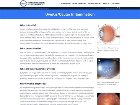 Uveitis/Ocular Inflammation - Retina-Vitreous Surgeons of CNY