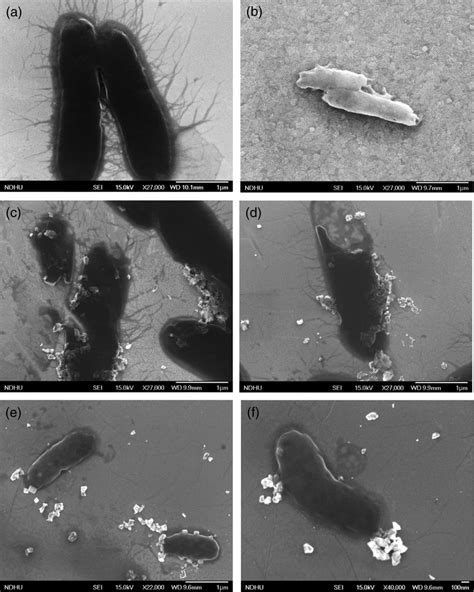 Scanning electron microscopy images of (a) E. coli, E. coli incubated ...