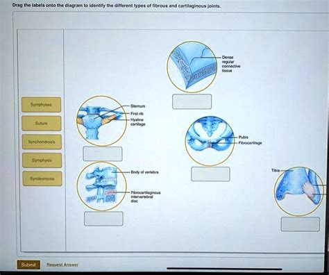 SOLVED: Drag the labels onto the diagram to identify the different types of fibrous and ...