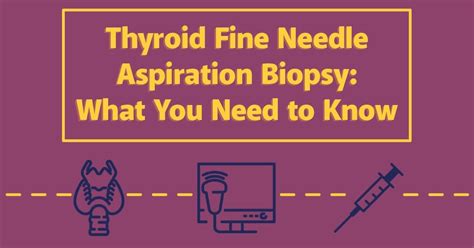 Thyroid Fine Needle Aspiration Biopsy: What You Need to Know | UVA Radiology