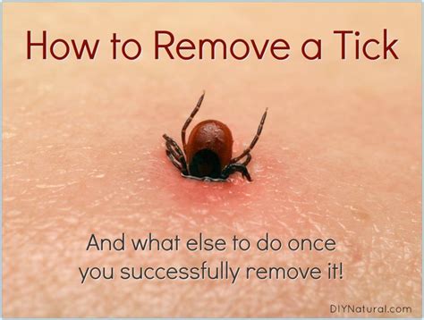 How to Remove A Tick: And What to Do Once You've Been Bitten | Ticks, Get rid of ticks, Clean ...