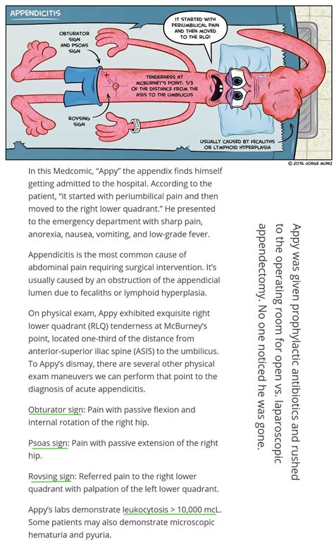 Appendicitis ... #psoas #appendix [ Dunphy sign - Any movement including coughing may increase ...