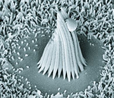 Difference Between Inner and Outer Hair Cells - Pediaa.Com