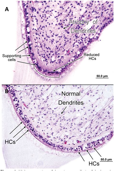 Otolithic Membrane Histology